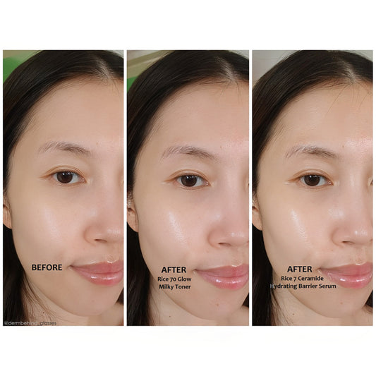 Anua 7 Rice Ceramide Hydrating Barrier Serum 50ml